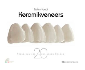 Keramikveneers