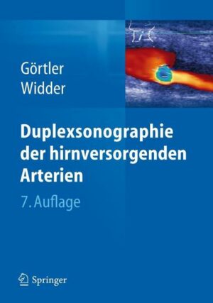 Duplexsonographie der hirnversorgenden Arterien