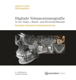 Digitale Volumentomografie in der Zahn-